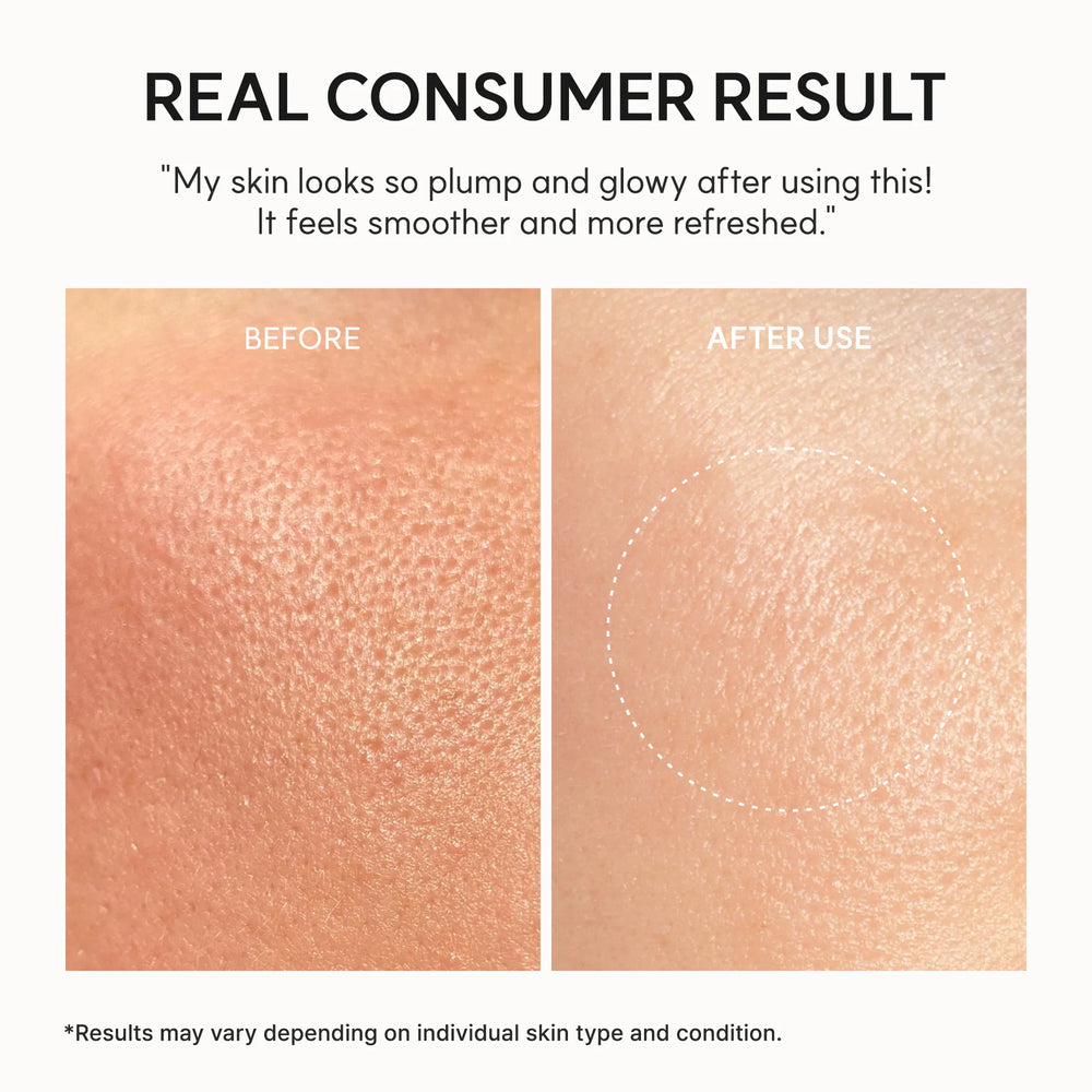 Arencia NAD+ Time-Rewind Booster Shot – Firming & Revitalizing Serum