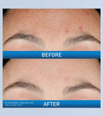 Resurfacing Retinol Serum